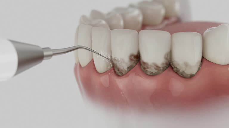Trusted Dental Implants service in La Selva Beach, CA - Dentist Open Now